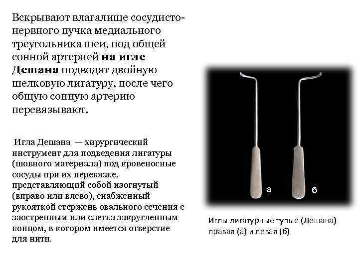 Вскрывают влагалище сосудистонервного пучка медиального треугольника шеи, под общей сонной артерией на игле Дешана