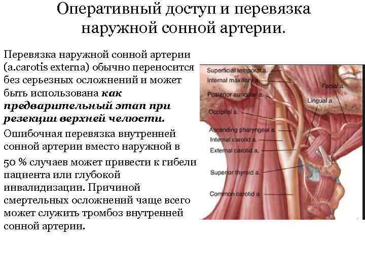 Оперативный доступ и перевязка наружной сонной артерии. Перевязка наружной сонной артерии (a. carotis externa)