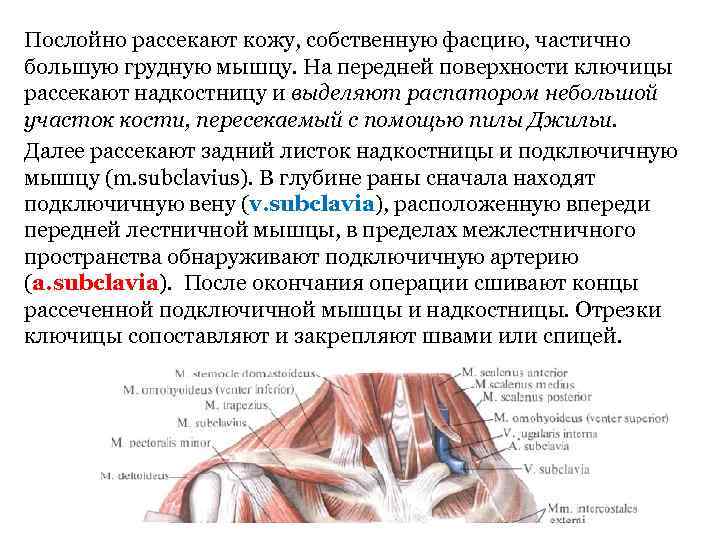 Послойно рассекают кожу, собственную фасцию, частично большую грудную мышцу. На передней поверхности ключицы рассекают