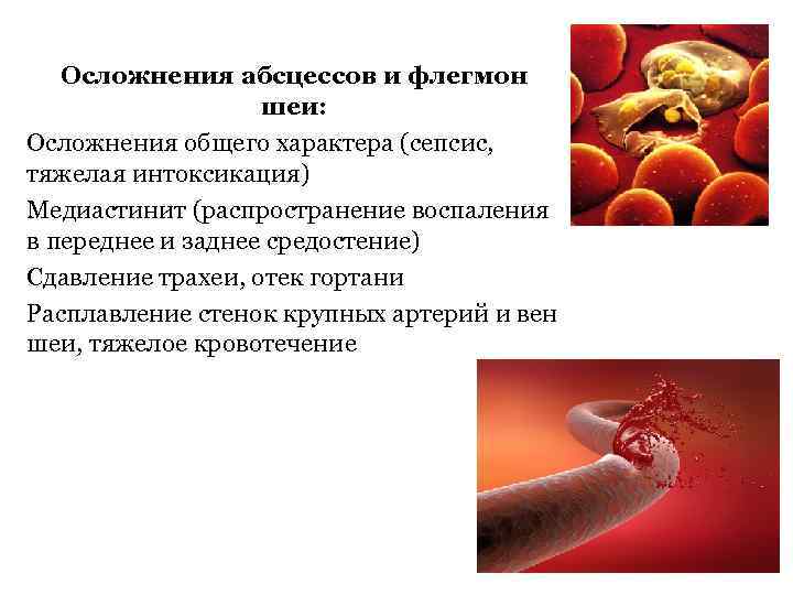 Осложнения абсцессов и флегмон шеи: Осложнения общего характера (сепсис, тяжелая интоксикация) Медиастинит (распространение воспаления