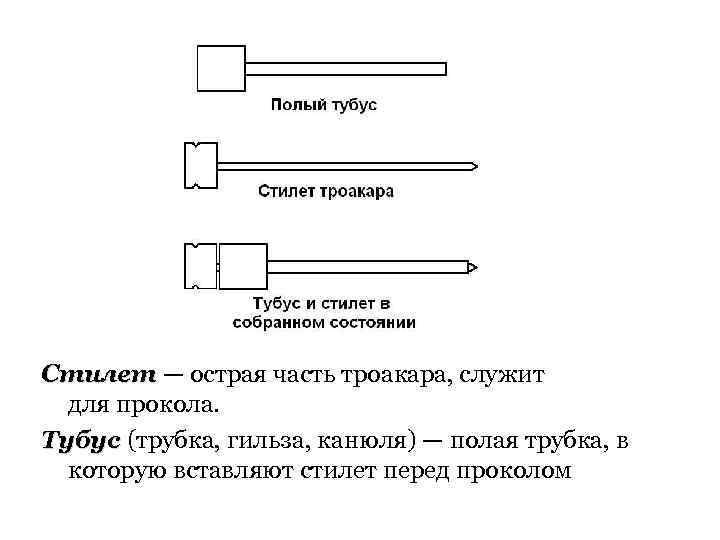 Стилет — острая часть троакара, служит для прокола. Тубус (трубка, гильза, канюля) — полая
