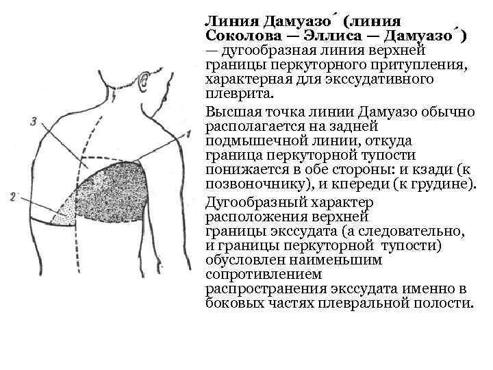 Экссудативный плеврит карта вызова скорой медицинской