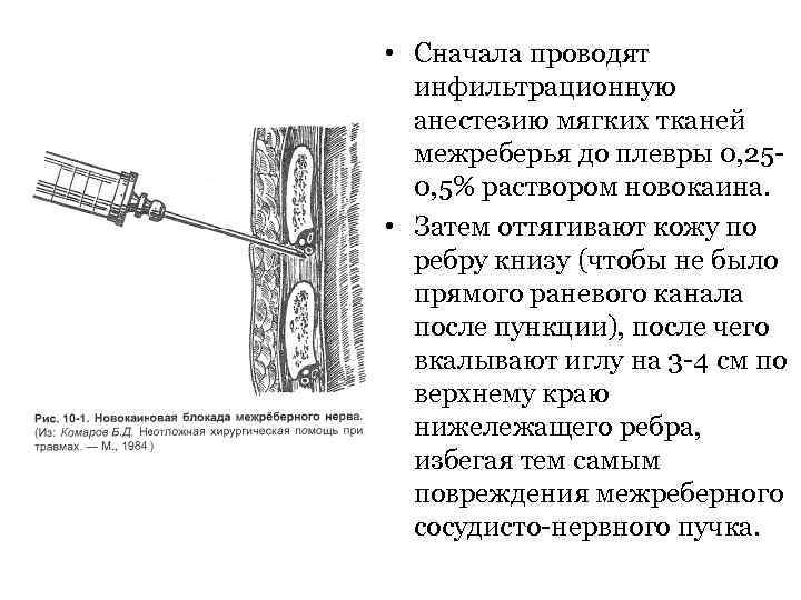 Пункция плевральной полости