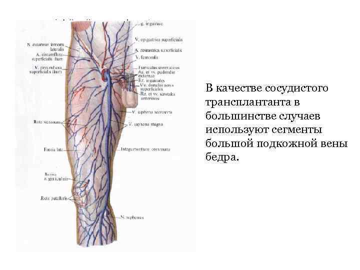  • В качестве сосудистого трансплантанта в большинстве случаев используют сегменты большой подкожной вены