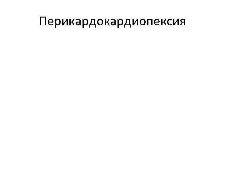 Перикардокардиопексия 