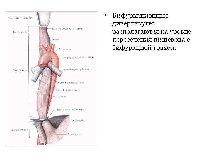  • Бифуркационные дивертикулы располагаются на уровне пересечения пищевода с бифуркцией трахеи. 