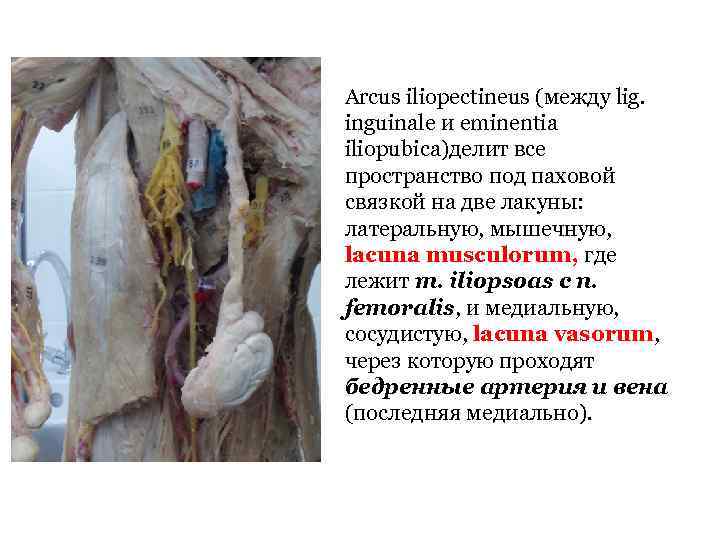 Arcus iliopectineus (между lig. inguinale и eminentia iliopubica)делит все пространство под паховой связкой на