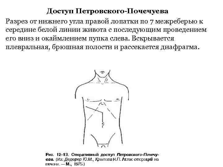 Доступ мерседес к печени