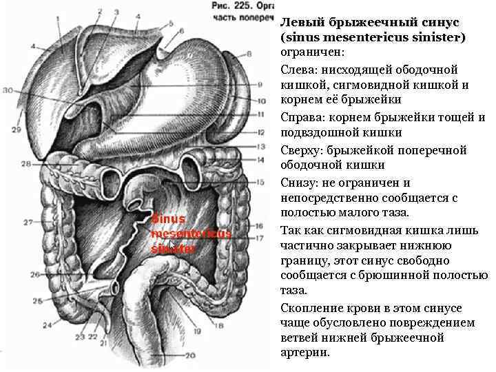 Левый сигмовидный синус