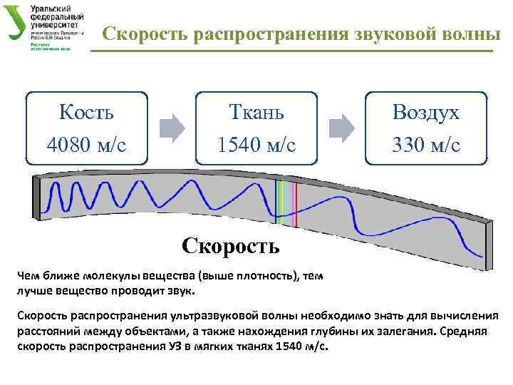 Скорость распространения звуковой волны Кость 4080 м/с Ткань 1540 м/с Воздух 330 м/с Скорость