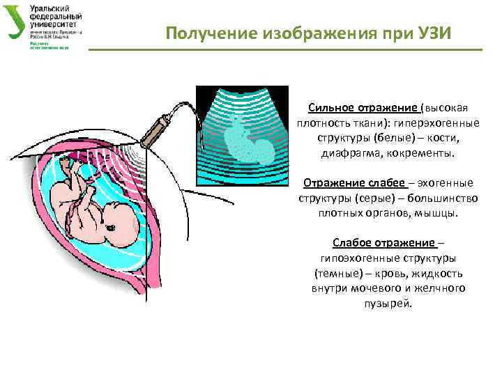 Получение изображения при УЗИ Сильное отражение (высокая плотность ткани): гиперэхогенные структуры (белые) – кости,