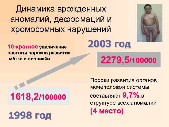 Динамика врожденных аномалий, деформаций и хромосомных нарушений 10 -кратное увеличение частоты пороков развития матки