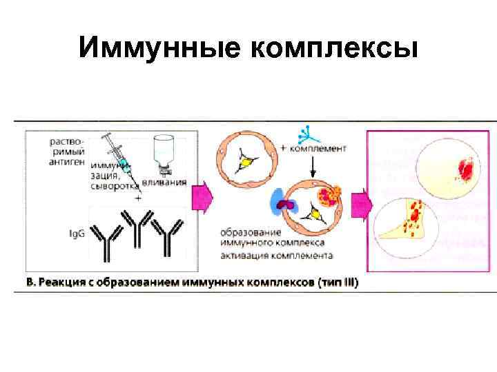 Иммунные комплексы 