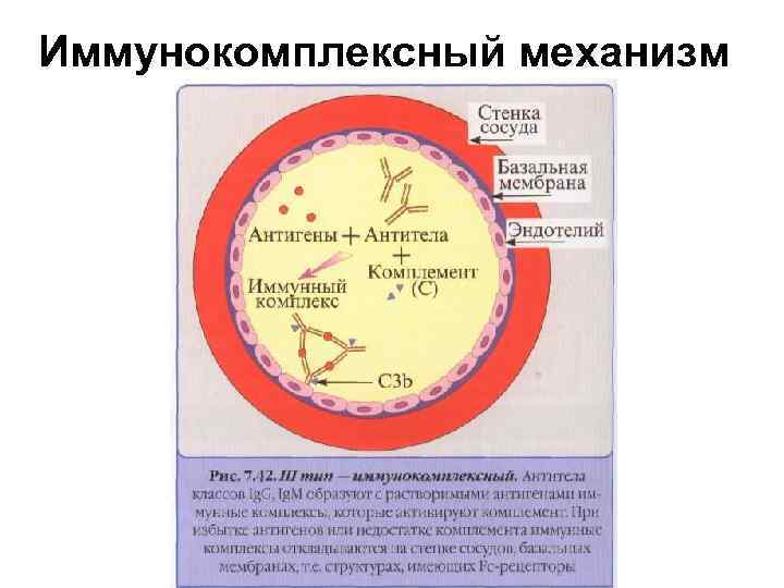 Иммунокомплексный механизм 