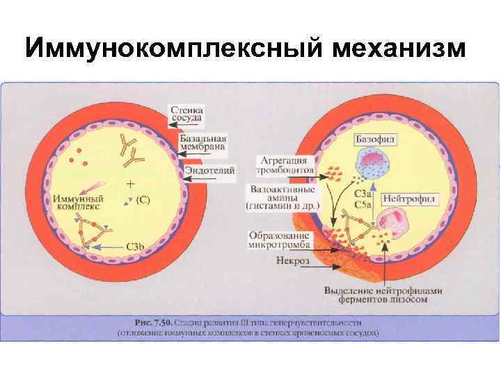 Иммунокомплексный механизм 