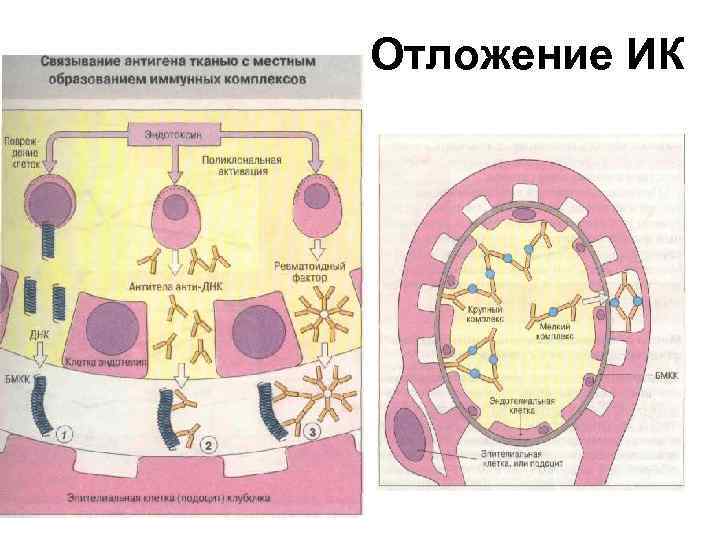 Отложение ИК 