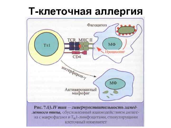 Т-клеточная аллергия 