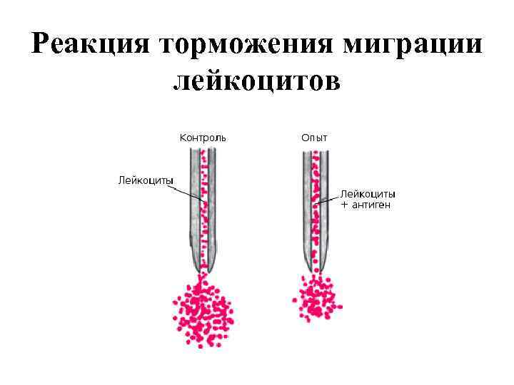 Реакция торможения миграции лейкоцитов 