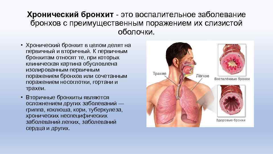 Хронический бронхит - это воспалительное заболевание бронхов с преимущественным поражением их слизистой оболочки. •