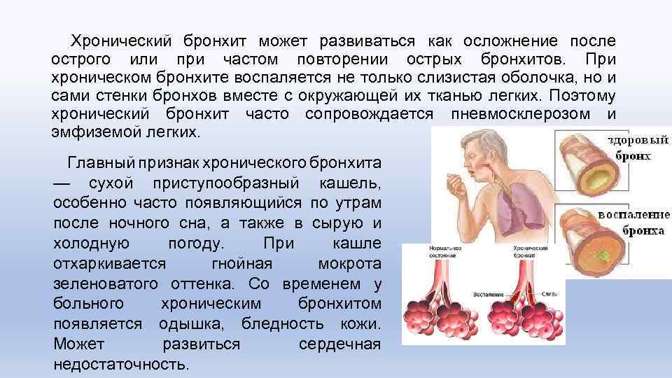 Хронический бронхит может развиваться как осложнение после острого или при частом повторении острых бронхитов.