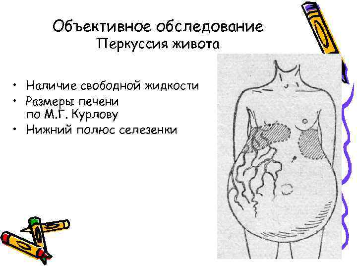 Объективное обследование Перкуссия живота • Наличие свободной жидкости • Размеры печени по М. Г.