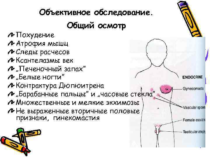 Объективное обследование. Общий осмотр Похудение Атрофия мышц Следы расчесов Ксантелазмы век „Печеночный запах” „Белые