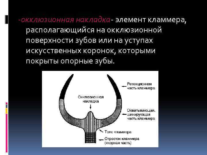 -окклюзионная накладка- элемент кламмера, располагающийся на окклюзионной поверхности зубов или на уступах искусственных коронок,
