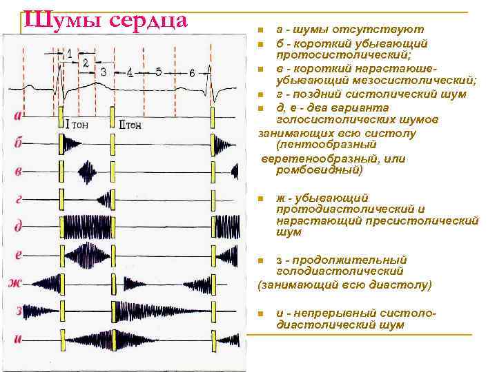 Шумы сердца пропедевтика презентация