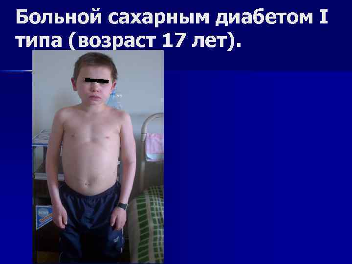 Больной сахарным диабетом I типа (возраст 17 лет). 