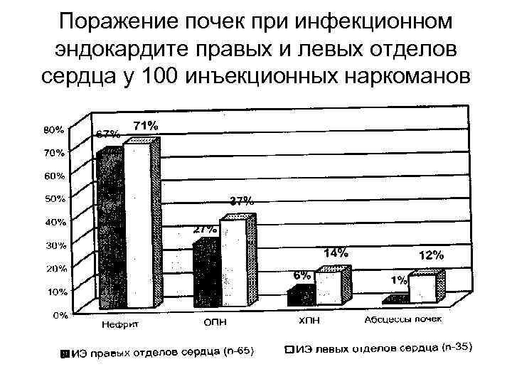 Поражение почек при инфекционном эндокардите правых и левых отделов сердца у 100 инъекционных наркоманов