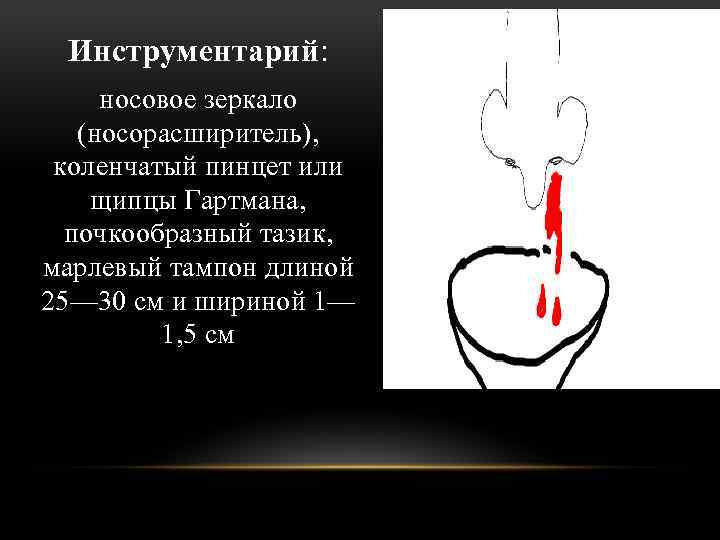Инструментарий: носовое зеркало (носорасширитель), коленчатый пинцет или щипцы Гартмана, почкообразный тазик, марлевый тампон длиной
