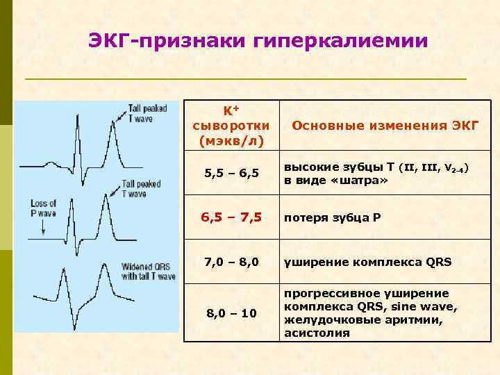 ЭКГ-признаки гиперкалиемии K+ сыворотки (мэкв/л) 5, 5 – 6, 5 – 7, 5 Основные