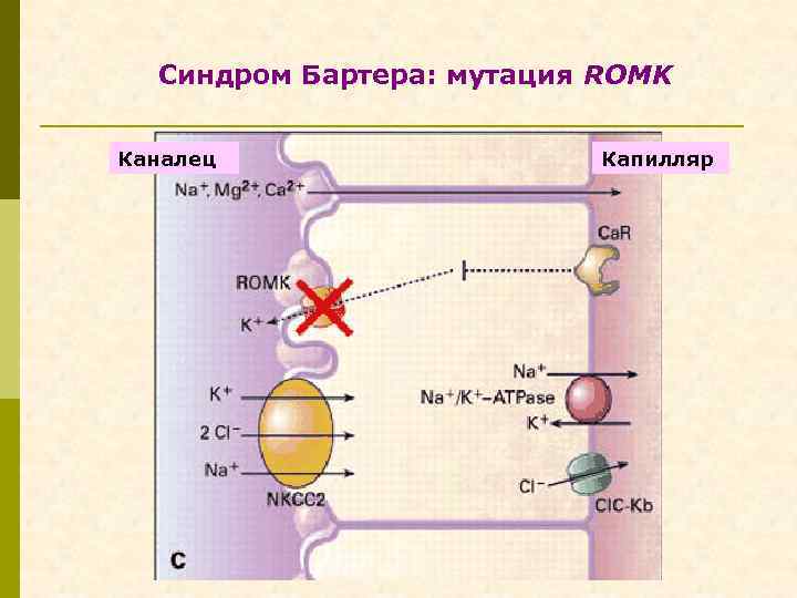 Синдром Бартера: мутация ROMK Каналец Капилляр 