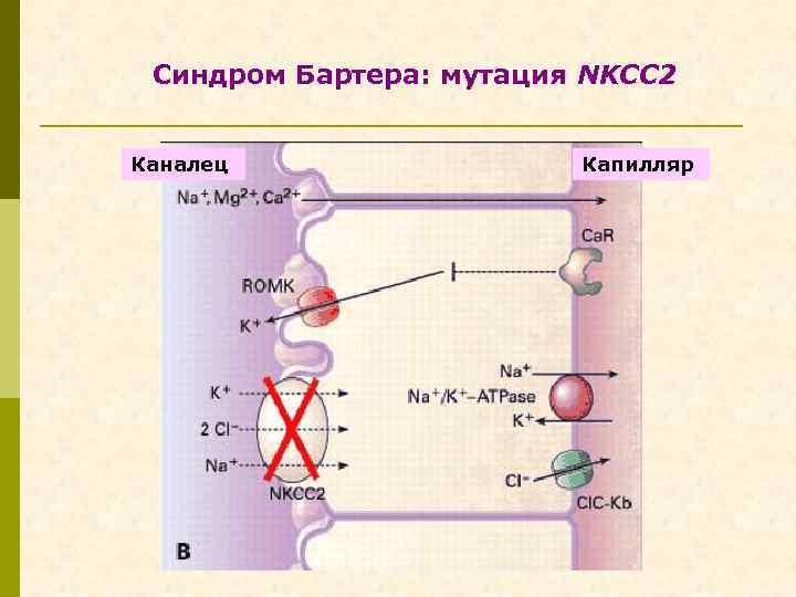 Синдром Бартера: мутация NKCC 2 Каналец Капилляр 