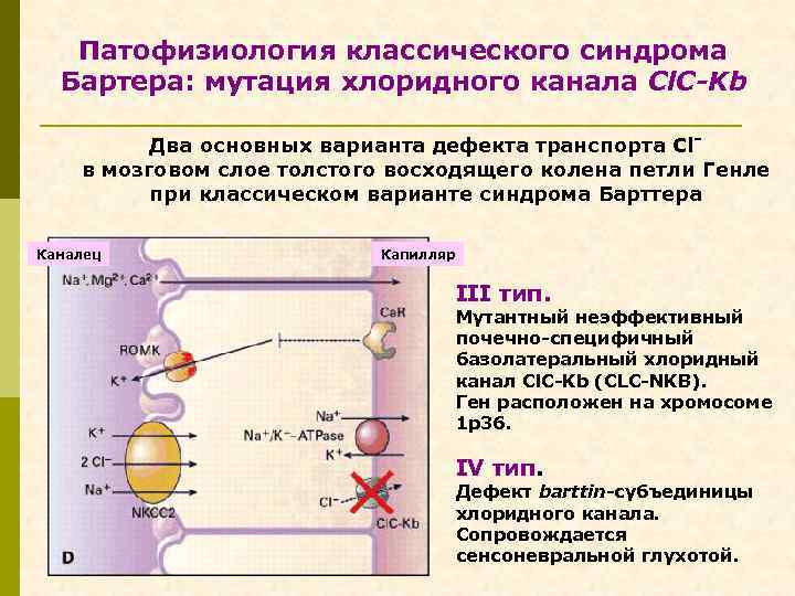 Патофизиология классического синдрома Бартера: мутация хлоридного канала Cl. C-Kb Два основных варианта дефекта транспорта