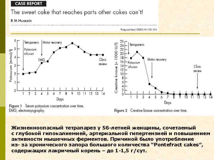 Жизненноопасный тетрапарез у 56 -летней женщины, сочетаемый с глубокой гипокалиемией, артериальной гипертензией и повышением