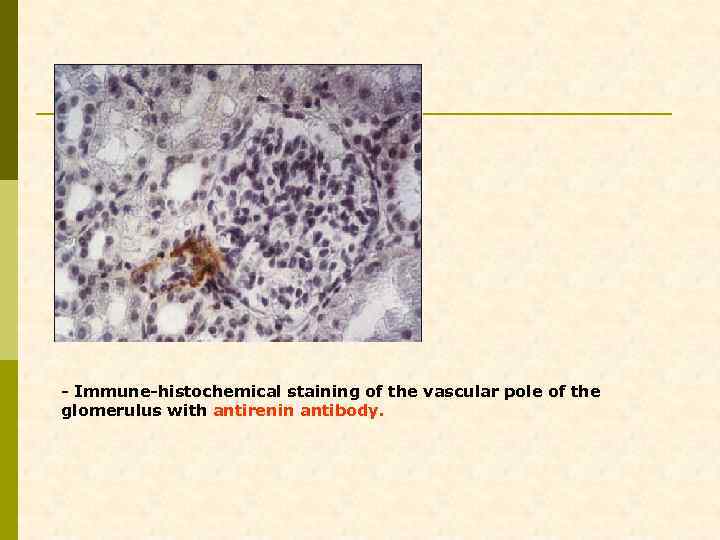 - Immune-histochemical staining of the vascular pole of the glomerulus with antirenin antibody. 