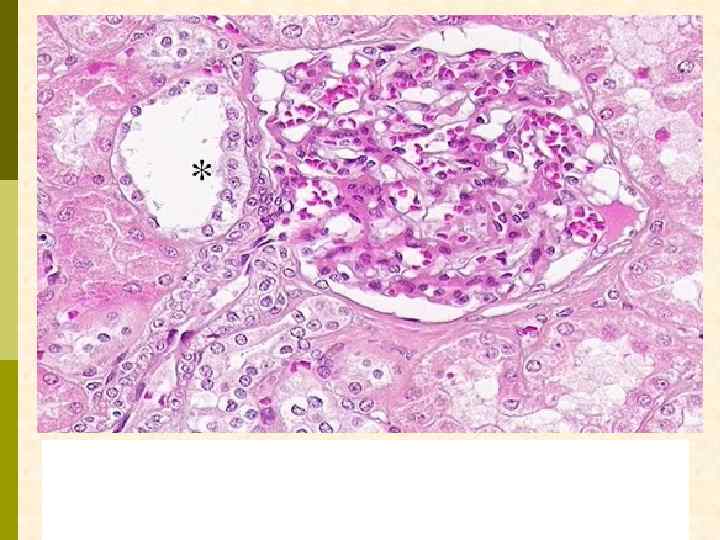 The asterisk marks the macula densa in the kidney. The macula densa is a