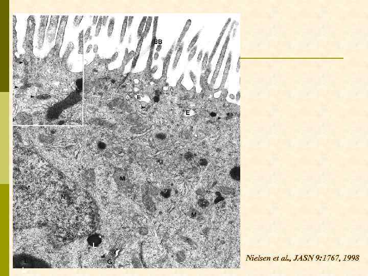 L Nielsen et al. , JASN 9: 1767, 1998 L 