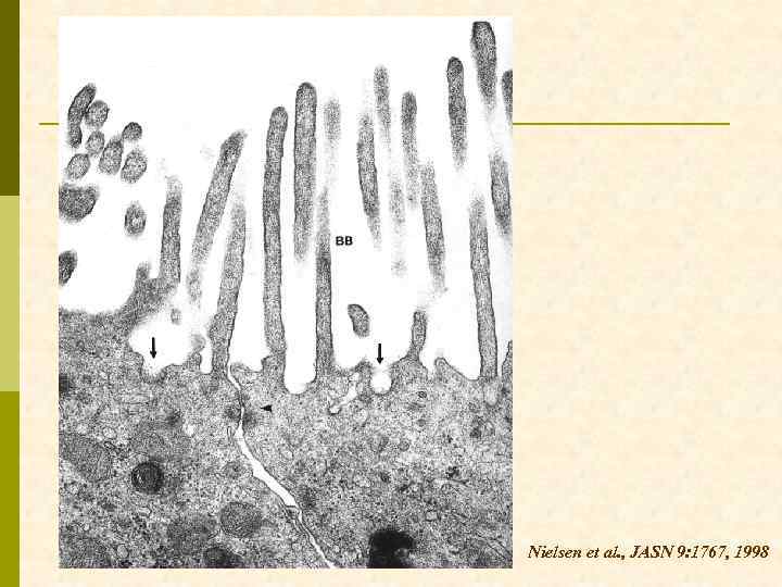 Nielsen et al. , JASN 9: 1767, 1998 