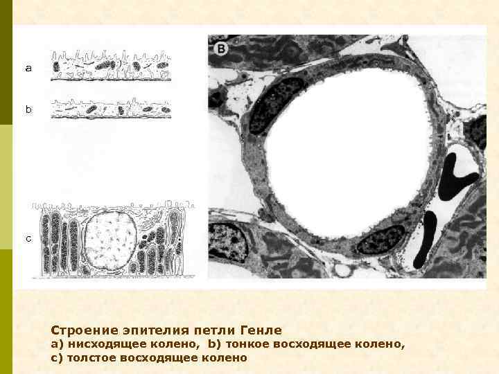 a b c Строение эпителия петли Генле a) нисходящее колено, b) тонкое восходящее колено,