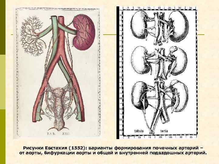 Рисунки Евстахия (1552): варианты формирования почечных артерий – от аорты, бифуркации аорты и общей