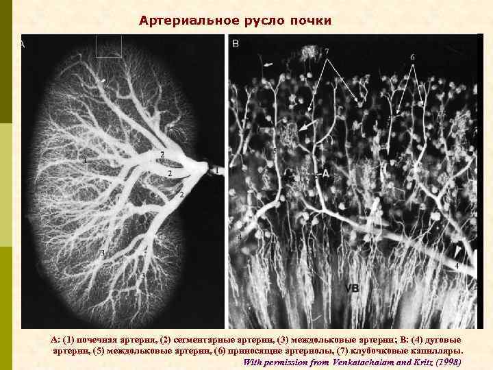 Артериальное русло почки А: (1) почечная артерия, (2) сегментарные артерии, (3) междольковые артерии; В: