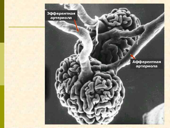 Эфферентная артериола Афферентная артериола 