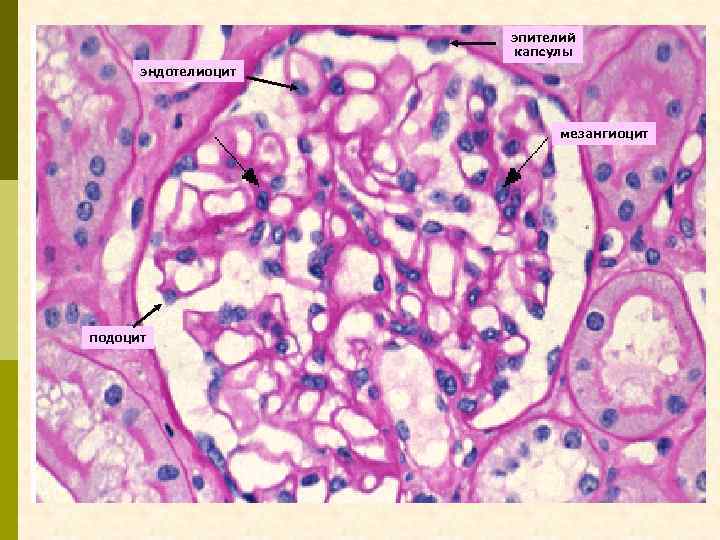 эпителий капсулы эндотелиоцит мезангиоцит подоцит 