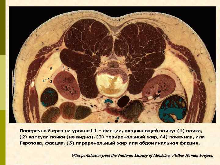 Поперечный срез на уровне L 1 – фасции, окружающей почку: (1) почка, (2) капсула