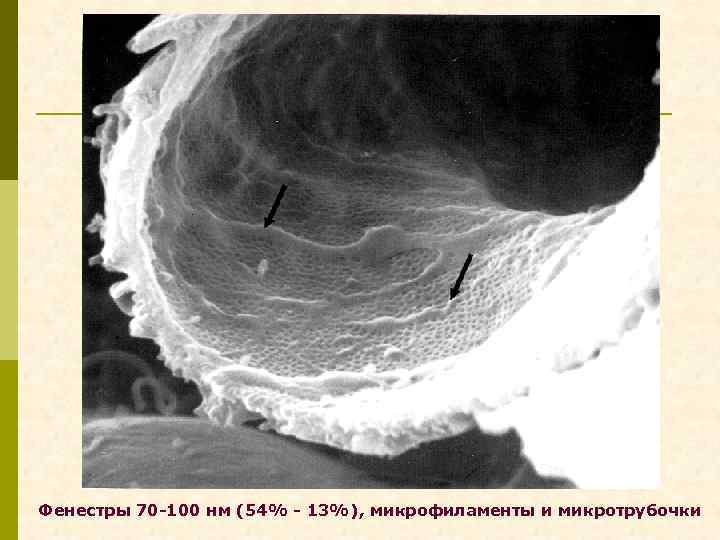 Фенестры 70 -100 нм (54% - 13%), микрофиламенты и микротрубочки 