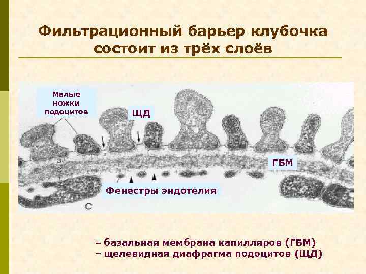 Фильтрационный барьер клубочка состоит из трёх слоёв Малые ножки подоцитов ЩД ГБМ Фенестры эндотелия