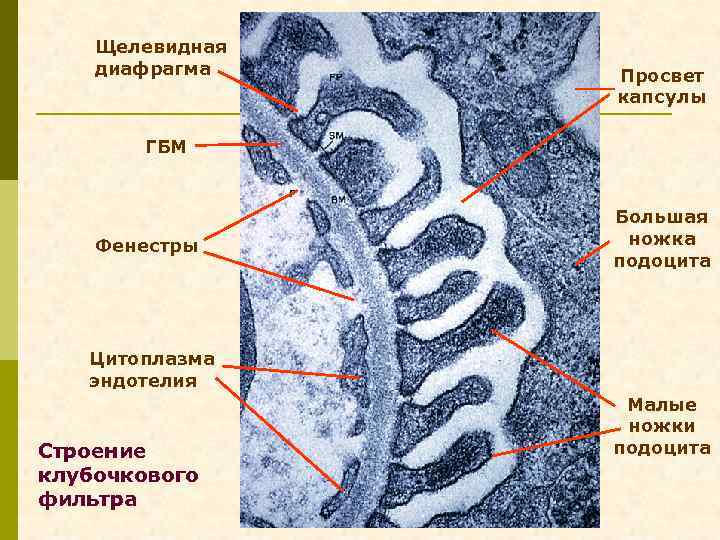 Щелевидная диафрагма Просвет капсулы ГБМ Фенестры Большая ножка подоцита Цитоплазма эндотелия Строение клубочкового фильтра