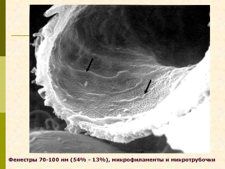Фенестры 70 -100 нм (54% - 13%), микрофиламенты и микротрубочки 